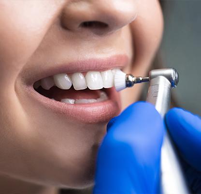 Dental Hygiene and Teeth Cleanings | Family Dentist | Dental Station | Calgary, AB