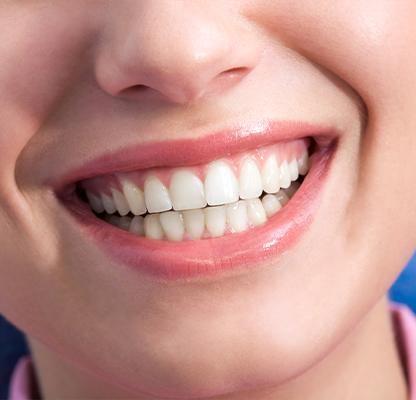 Dental Hygiene and Teeth Cleanings | Family Dentist | Dental Station | Calgary, AB