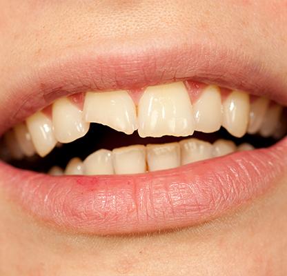 Calgary Emergency Dentistry | Family Dentist | Dental Station | Calgary, AB