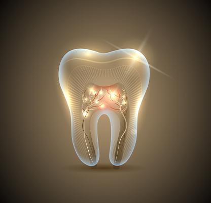 Root Canal Therapy | Calgary Family Dentist | Dental Station | Calgary, AB